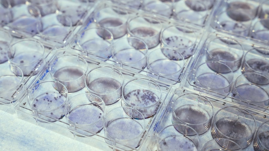 A full table of virus samples shown in petri dishes under laboratory lights