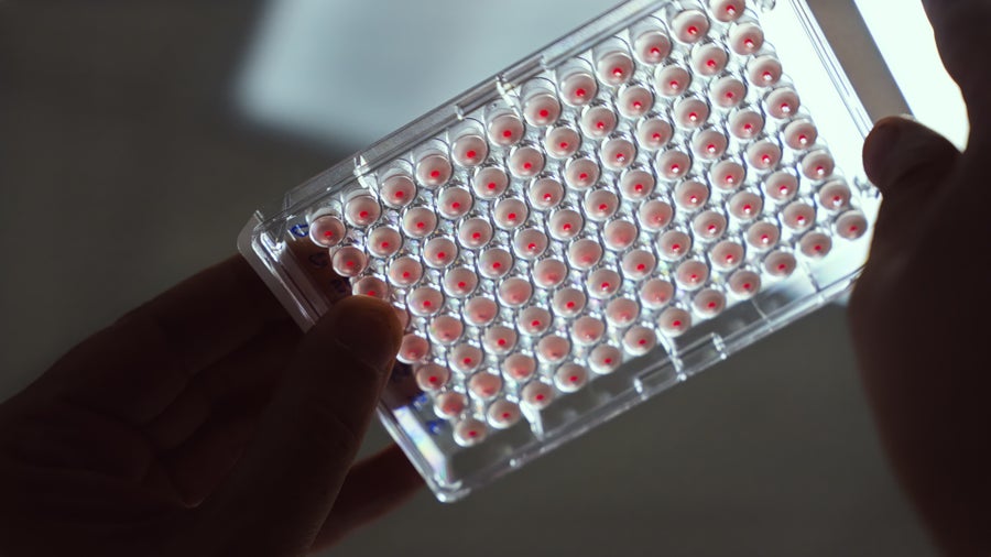 Two hands hold up a gridded sample holder to the light which shines through the holder and samples showing that the wells contain pink liquid with a red dot in the middle of each well