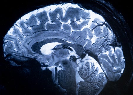 MRI shows a brain during a magnetic resonance imaging (MRI) exam simulation