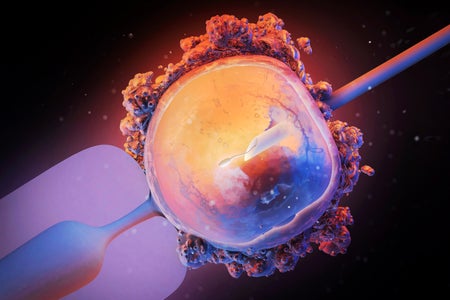 Digital illustration, ICSI stage of in vitro fertilization with human ovum and sperm