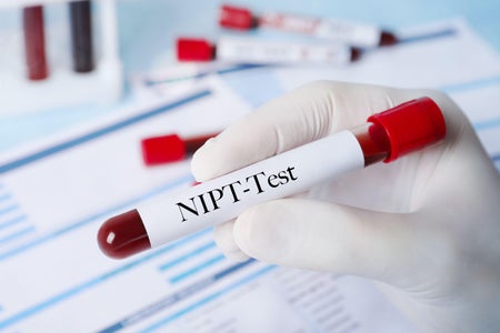 White gloved hand holding test tube with blood sample in laboratory with NIPT Test Letters.