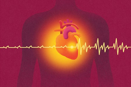 Illustration of a human body in silhouette with a glowing heart and light representing a pacemaker, and a pulse from a heart rate monitor overlaid