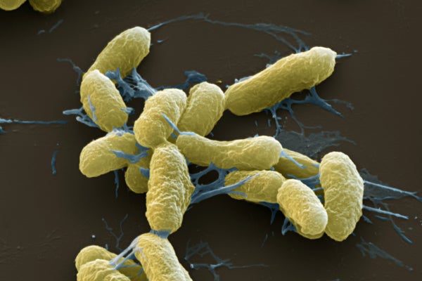 Yersinia pestis imaged with a color-enhanced scanning electron micrograph (SEM)