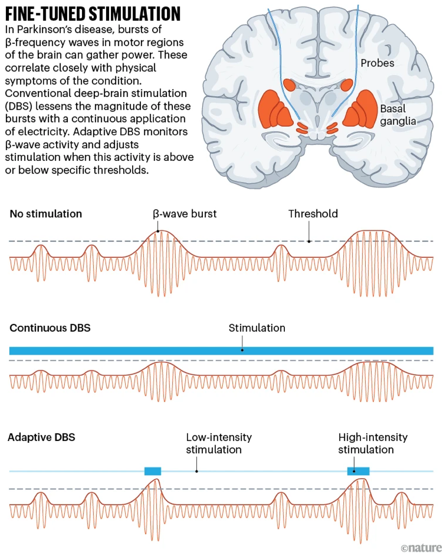 Graphic showing how continuous DBS compares to adaptive DBS.